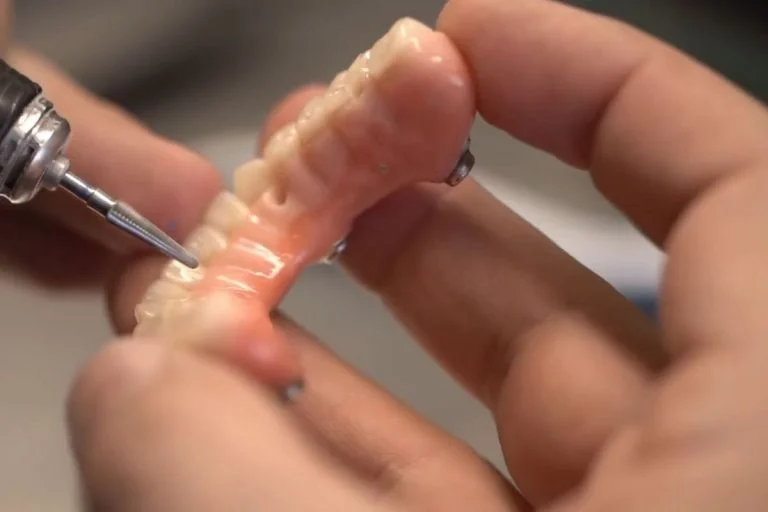 All-on-4 à Bucarest