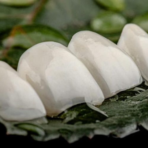 Facette dentaire Roumanie